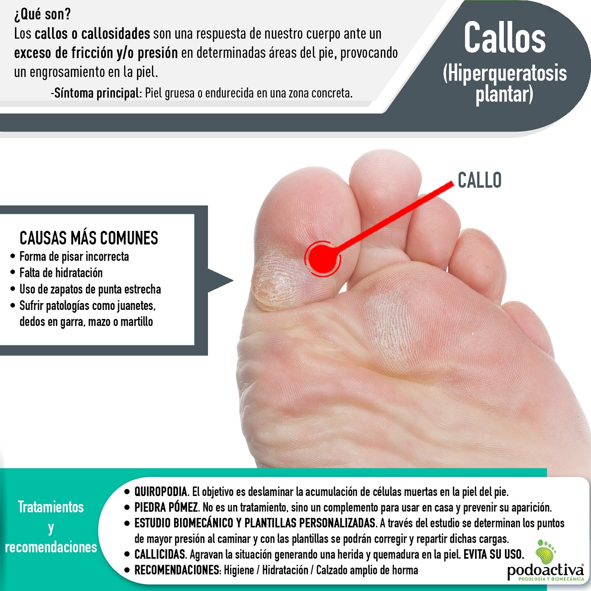 infografía de Podoactiva con información sobre los callos